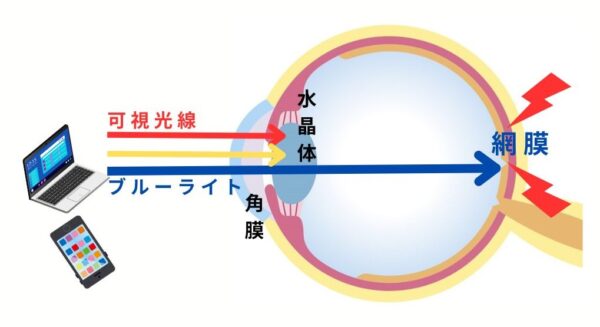 ブルーライトの目の影響